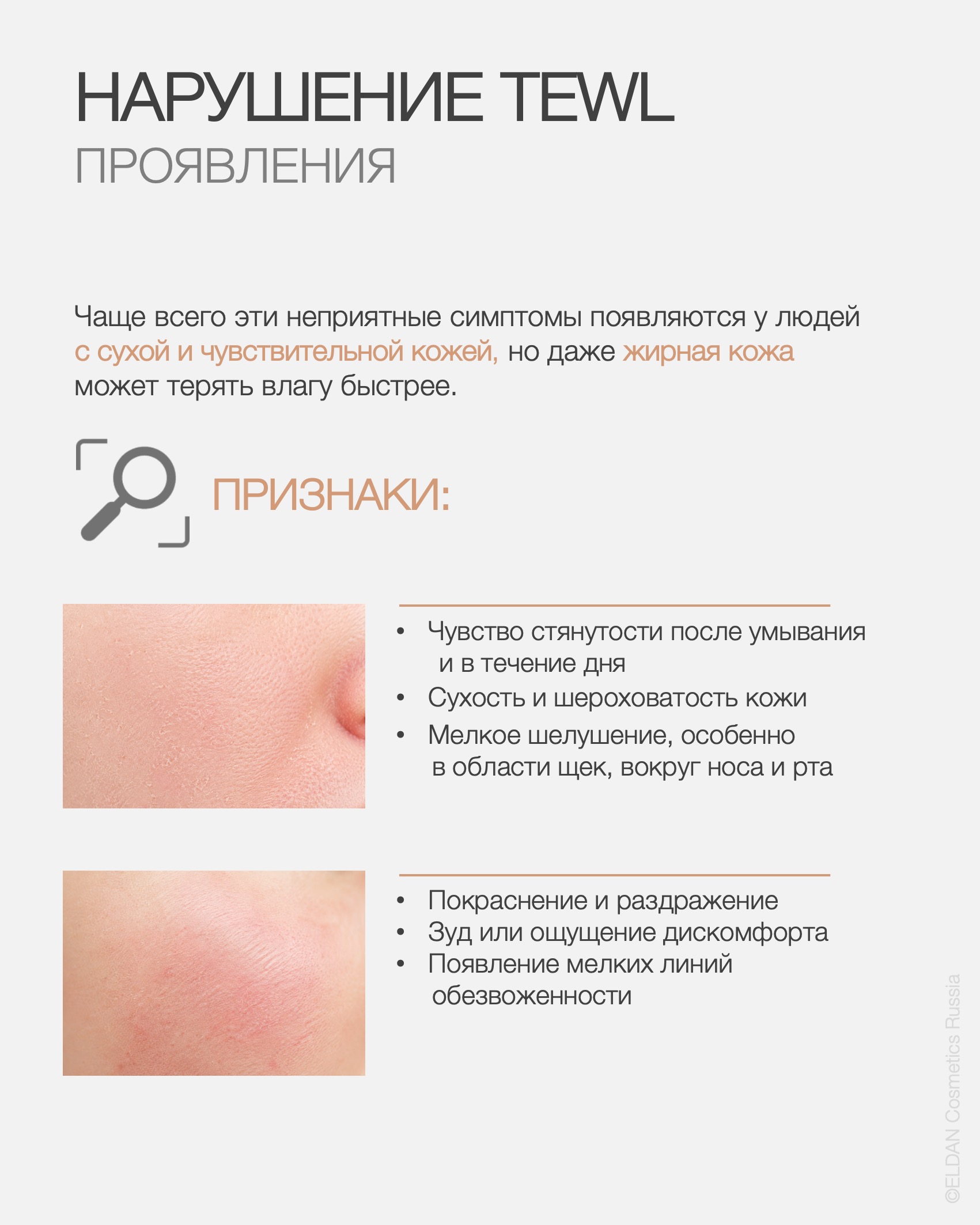 Пост нарушение TEWL летом 4.jpg